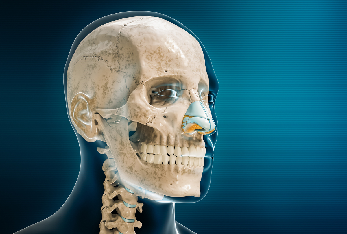 Rinoplastia en el traumatismo nasal